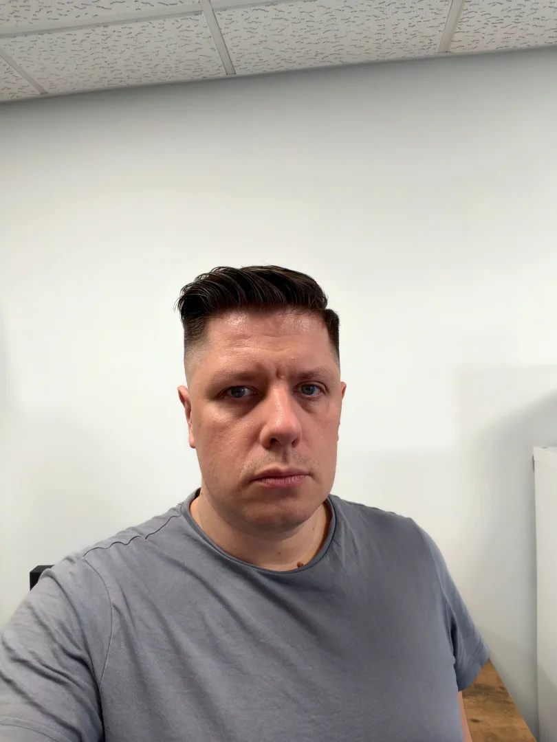 aparat przedni vivo x300